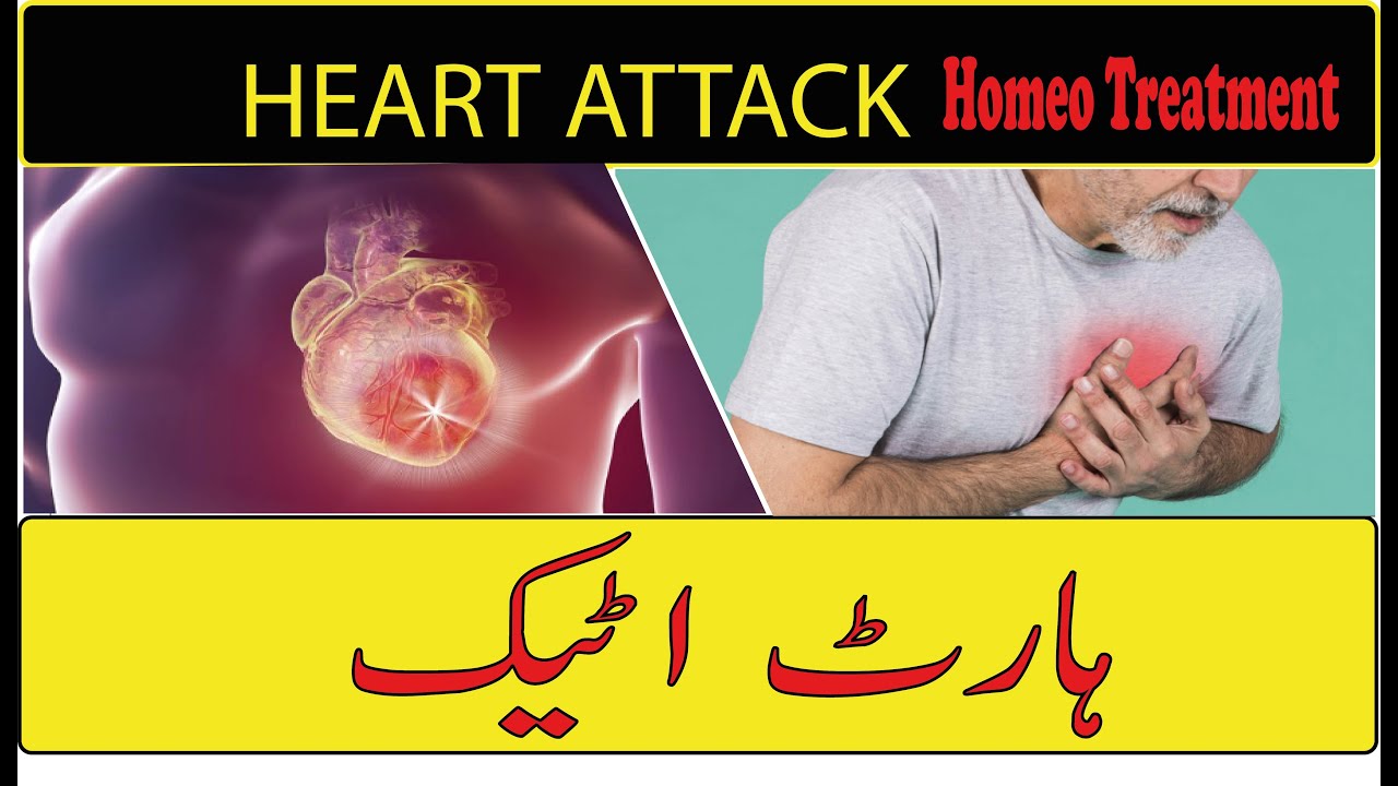 Heart Attack ki Allamat ll wajohat l causes ll Homeo treatment|Homoeo Dr Muhammad Aslam