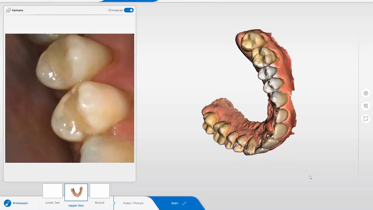 Mastering Digital Dentistry: Full Upper Jaw Scan with Primescan and CEREC SW 5