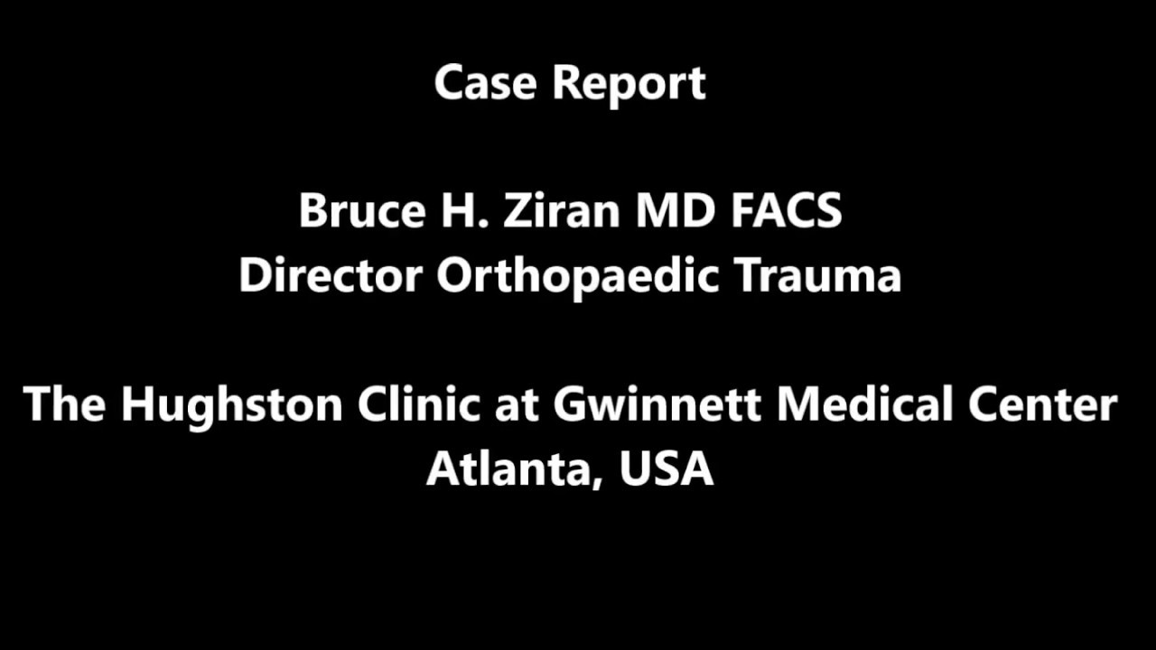 CarboFix Tibia Nail Case Report
