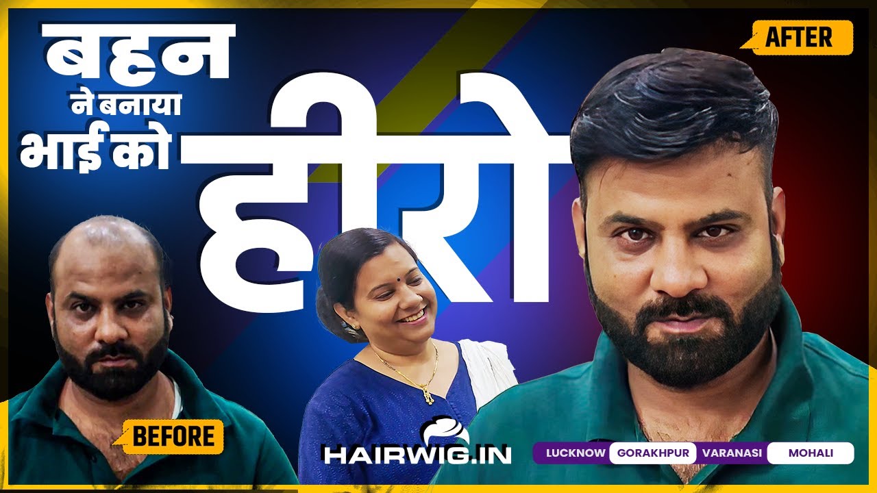 Men Hair Patch #style #transformation #PinkiSingh #lucknow #trending #viral #hairwig #hairwig