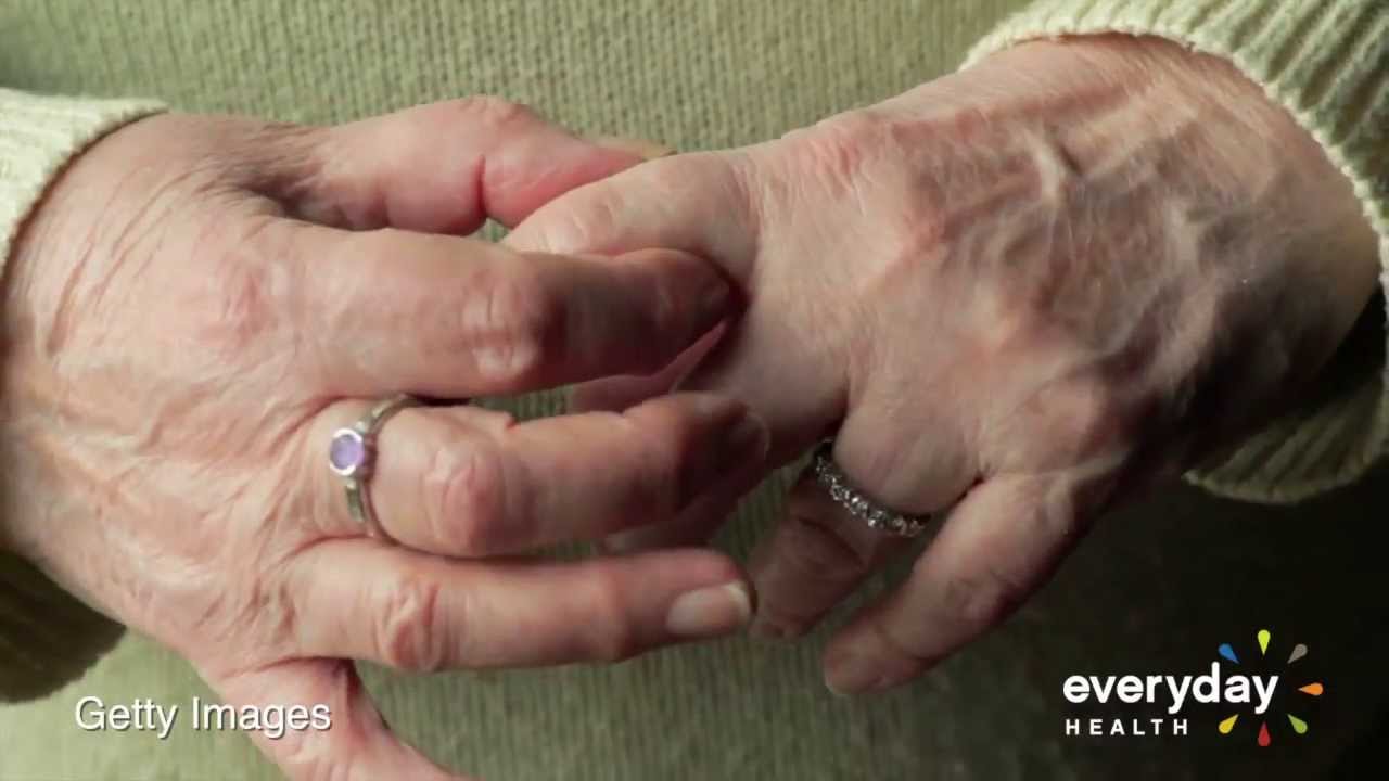 5 советов по физическим упражнениям при ревматоидном артрите