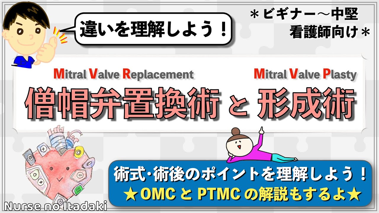 【決定的な違いとは？】僧帽弁置換術と形成術について理解しよう！