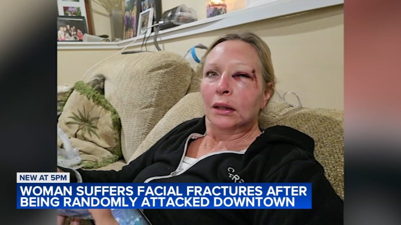 Suburban woman punched, knocked out downtown Chicago