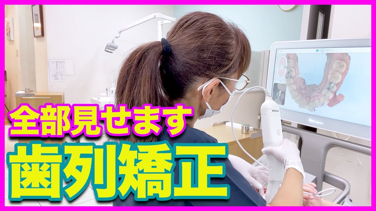 【全部見せます】歯列矯正はじめます！精密検査の流れまで大公開！