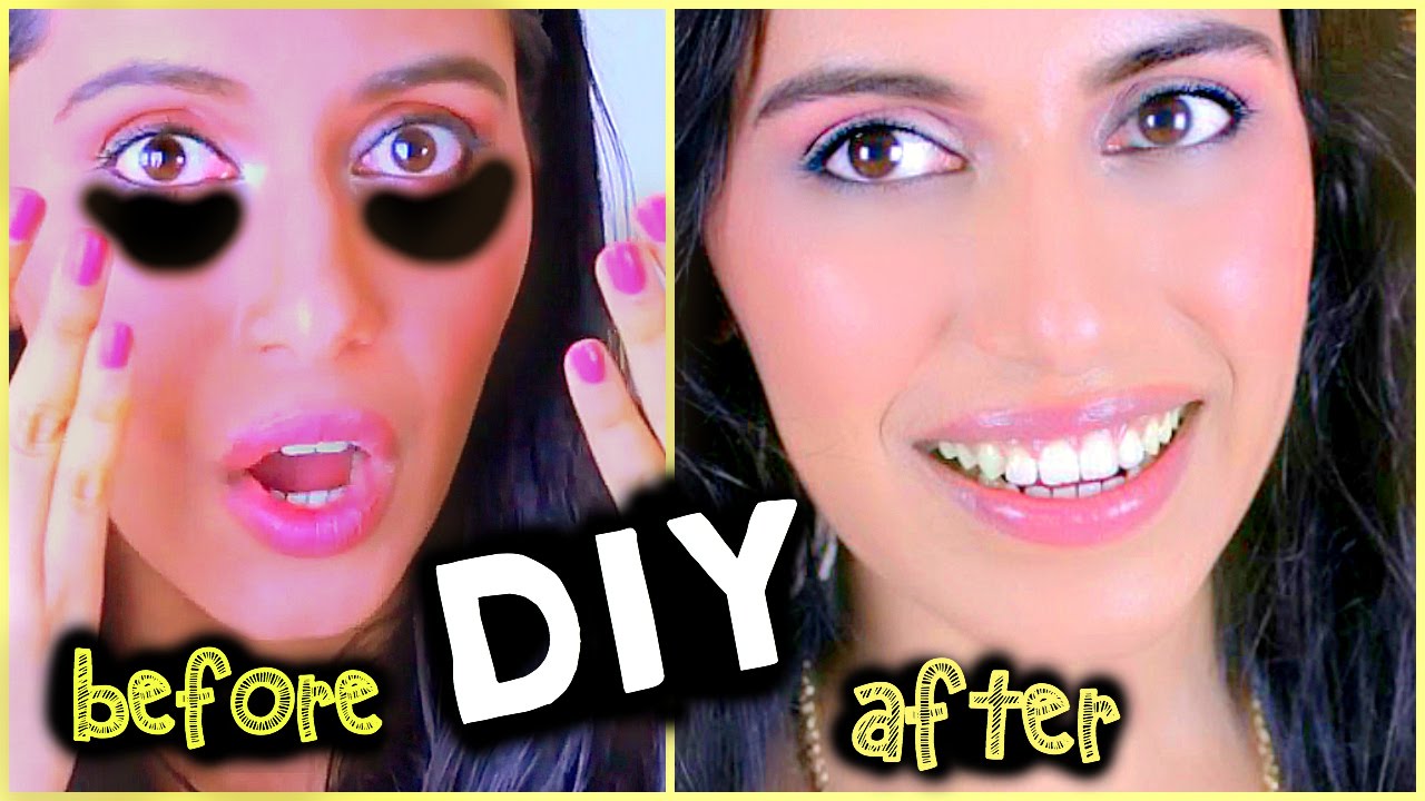 DIY How to Get Rid of Dark Circles under eyes NATURALLY | Truly Works!!!