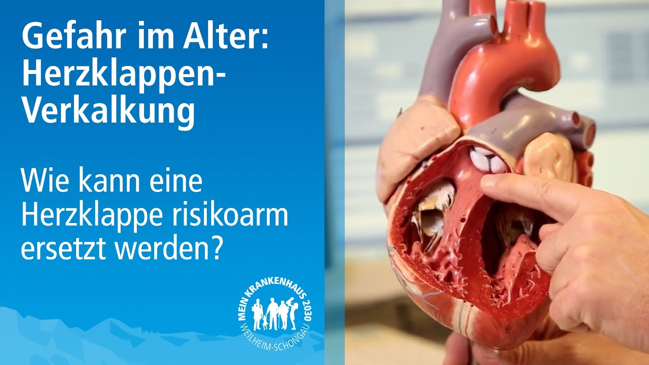 Künstliche Herzklappe bei Herzklappen-Verkalkung | Herzklappenersatz per Katheter | Prof. Knez