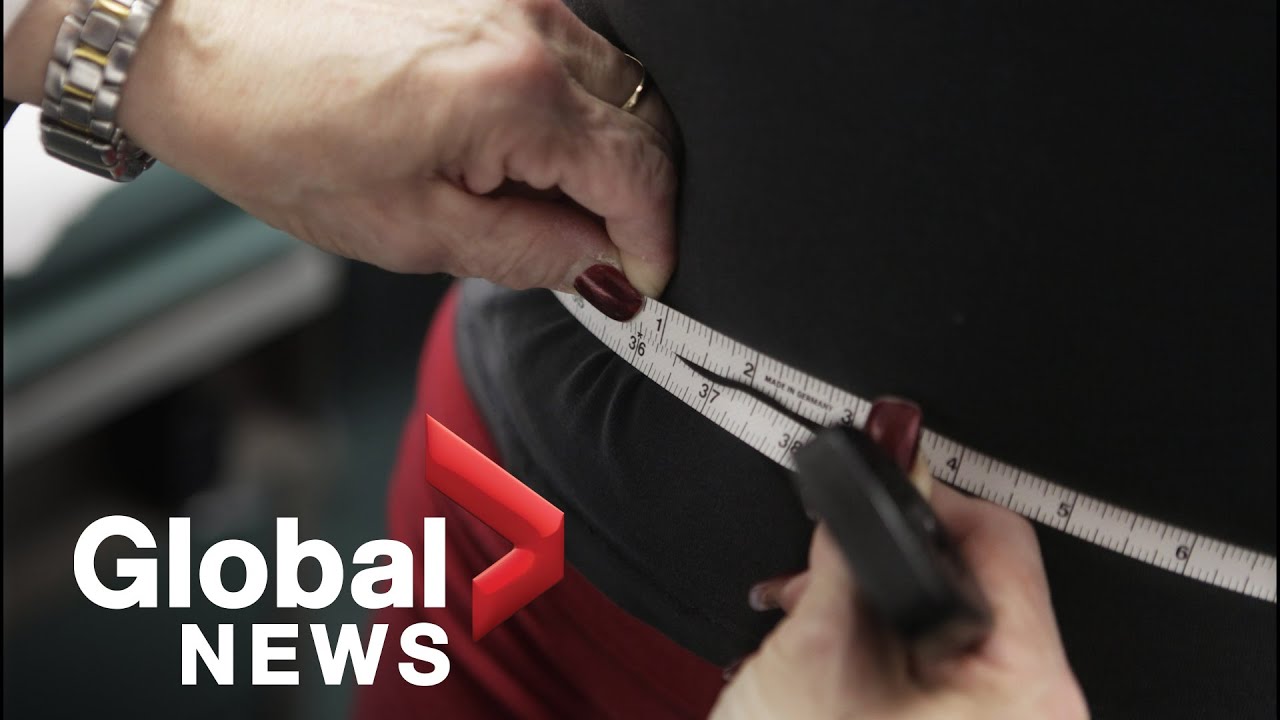 Stop calorie counting: New obesity treatment guidelines