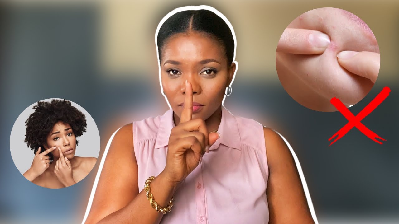 Stop doing these to your skin! | Dr Janet