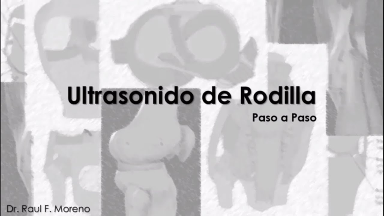Ultrasonido de Rodilla paso por paso