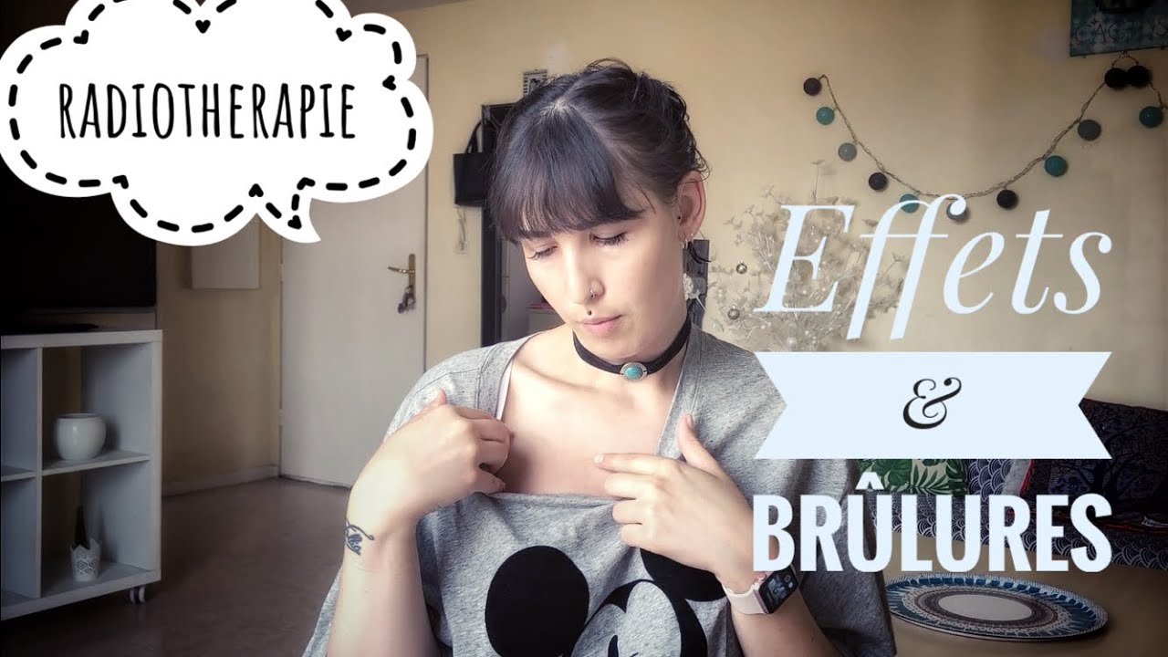 RADIOTHÉRAPIE : 1 an après (Cancer du sein)