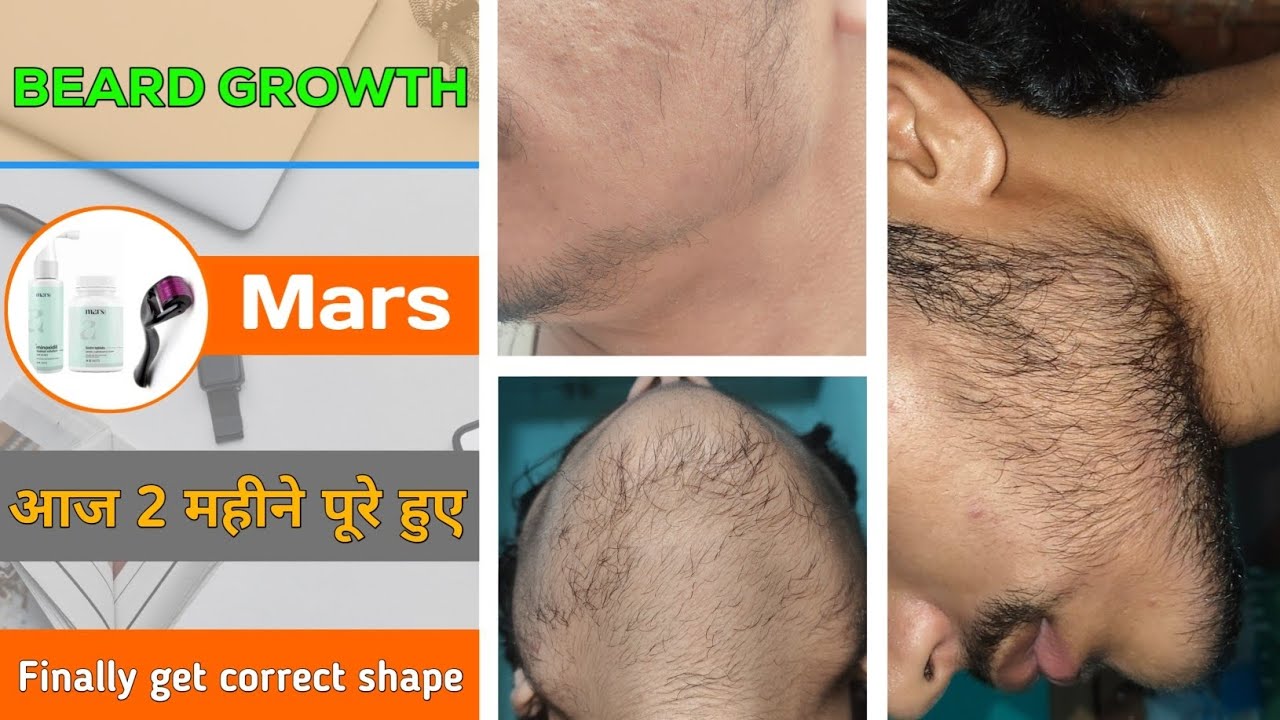 BEARD GROWTH ! Finally get fully correct beard shape ! It's been 2 months today ! आज 2 महीने पूरे 