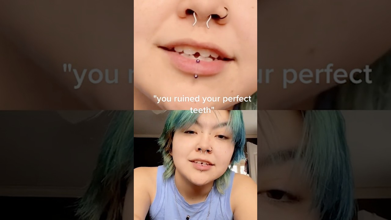 How This Common Piercing RUINED Her Teeth! 😮🦷