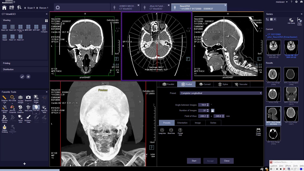 View&Go(Ranges) Parallel-Radial-Curved-Spine-Vascular Ranges