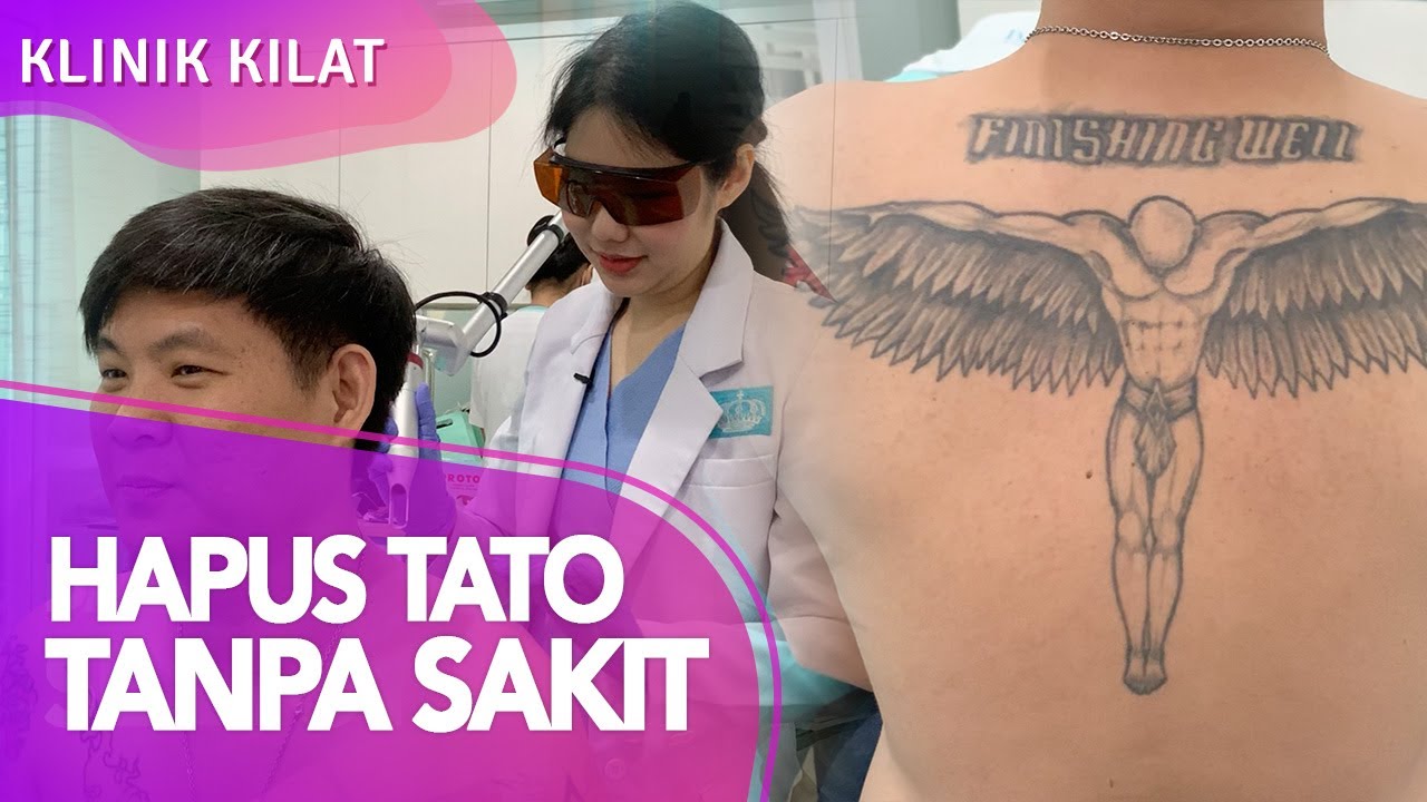 Hapus Tato, Tak Sesakit dan Seperih Kenangan Mantan - KLINIK KILAT