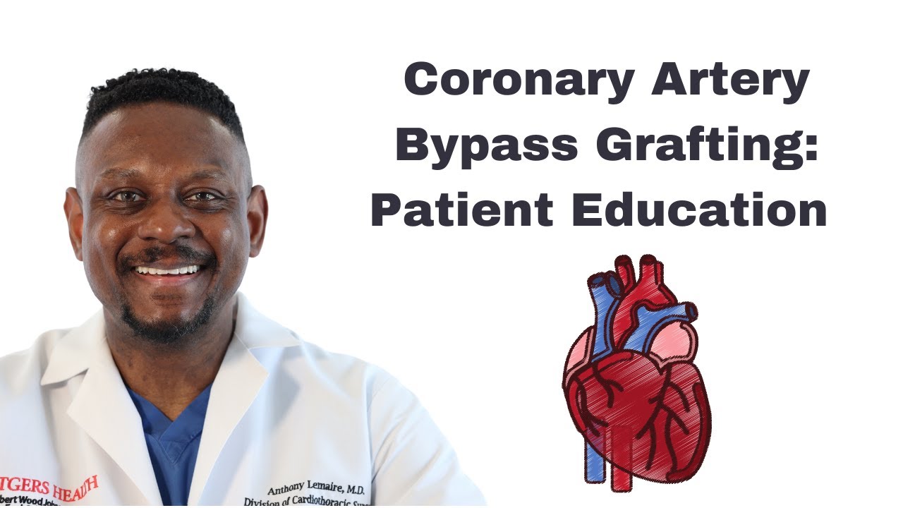 How to Perform Coronary Artery Bypass Grafting