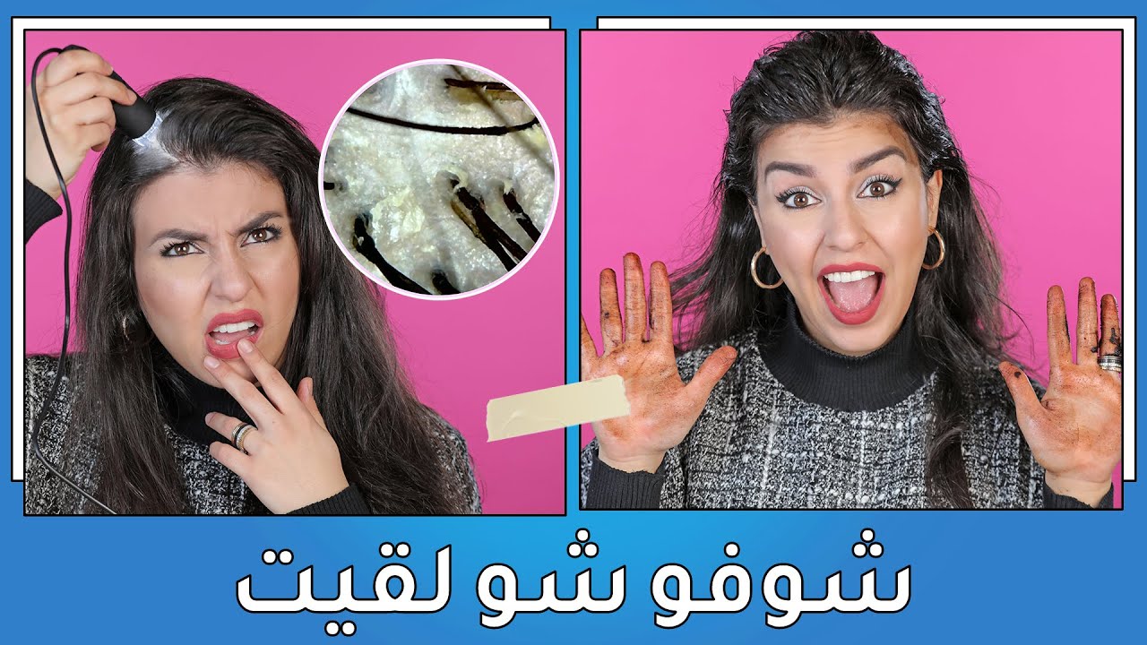 ردة فعلي بعد استخدام الميكروسكوب على شعري 🤢| خلطة تقشير وتنظيف فروة الرأس | مع جويل