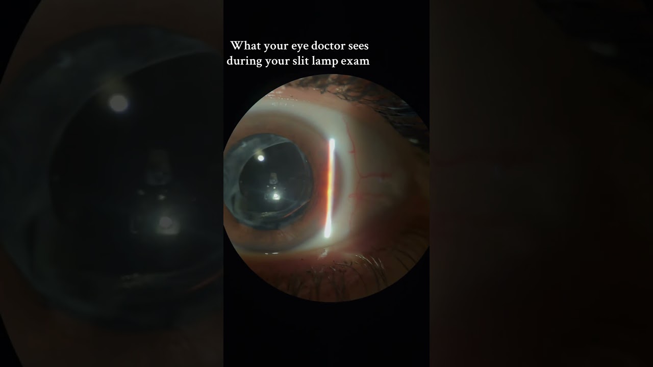 This view never gets old! #optometryasmr #doctorasmr #eyecheckup #eyeexam #medicalasmr #slitlamp