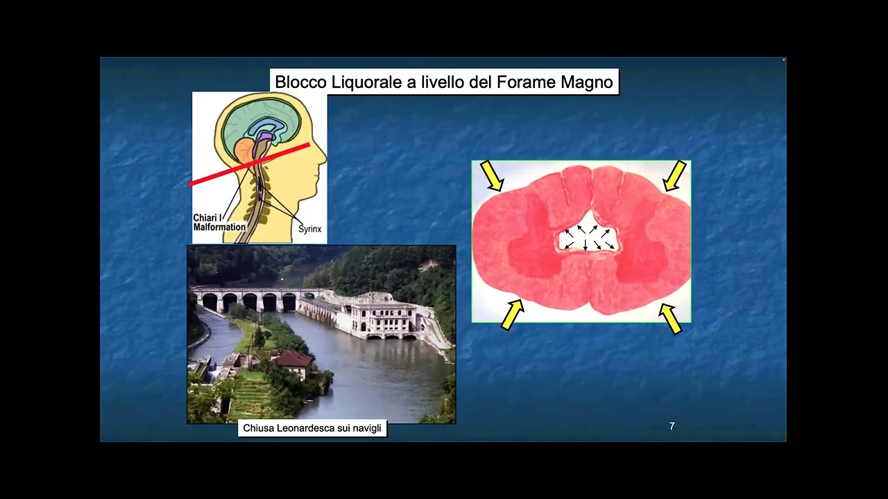 Intervento Giuseppe Talamonti