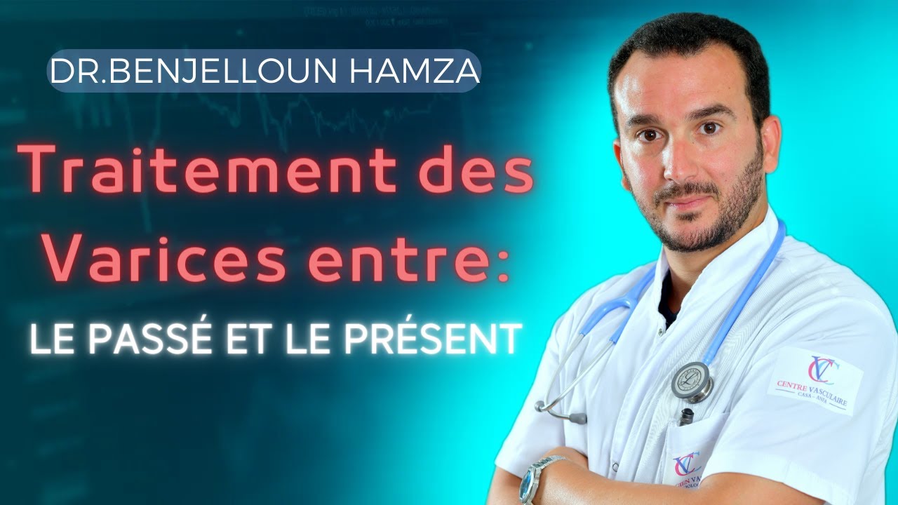 Traitement des Varices entre: le pass&eacute; et le pr&eacute;sent