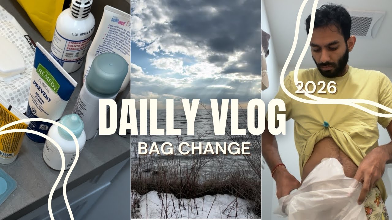 Ostomy boy Daily Vlog | Most Amazing Beach View 🏖️ | Peaceful & Relaxing Moments