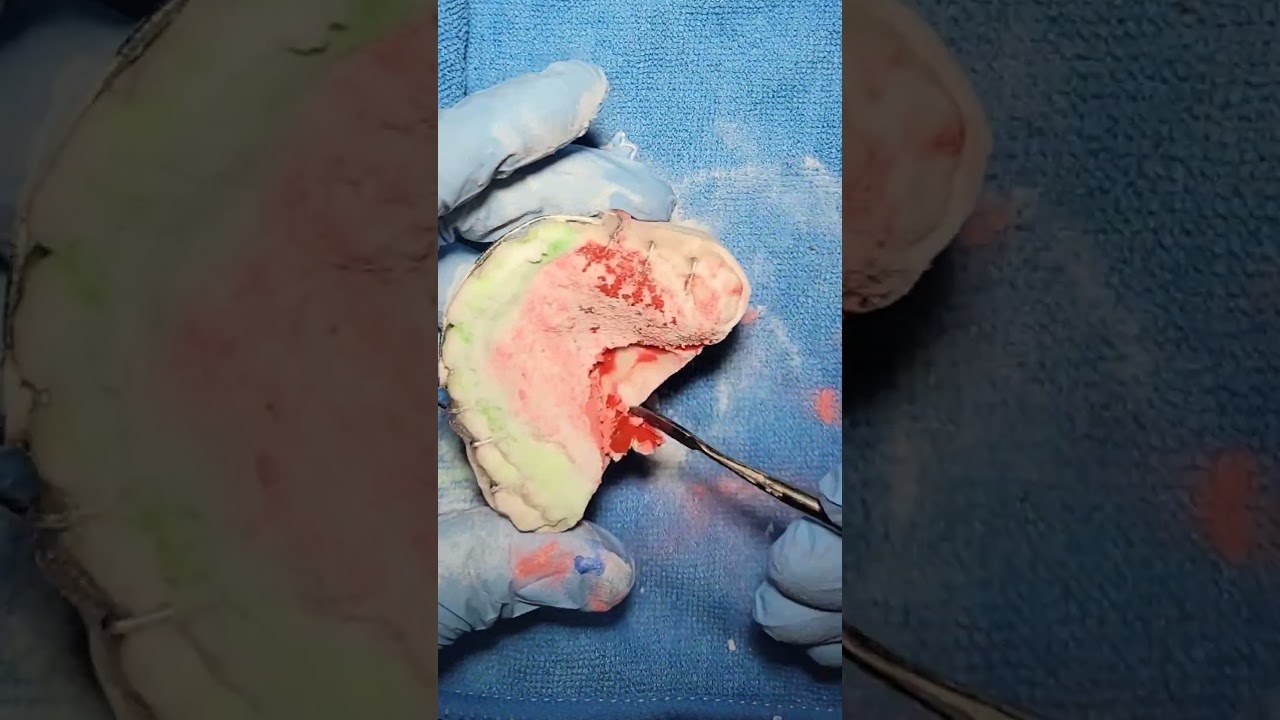 Watermelon retainer