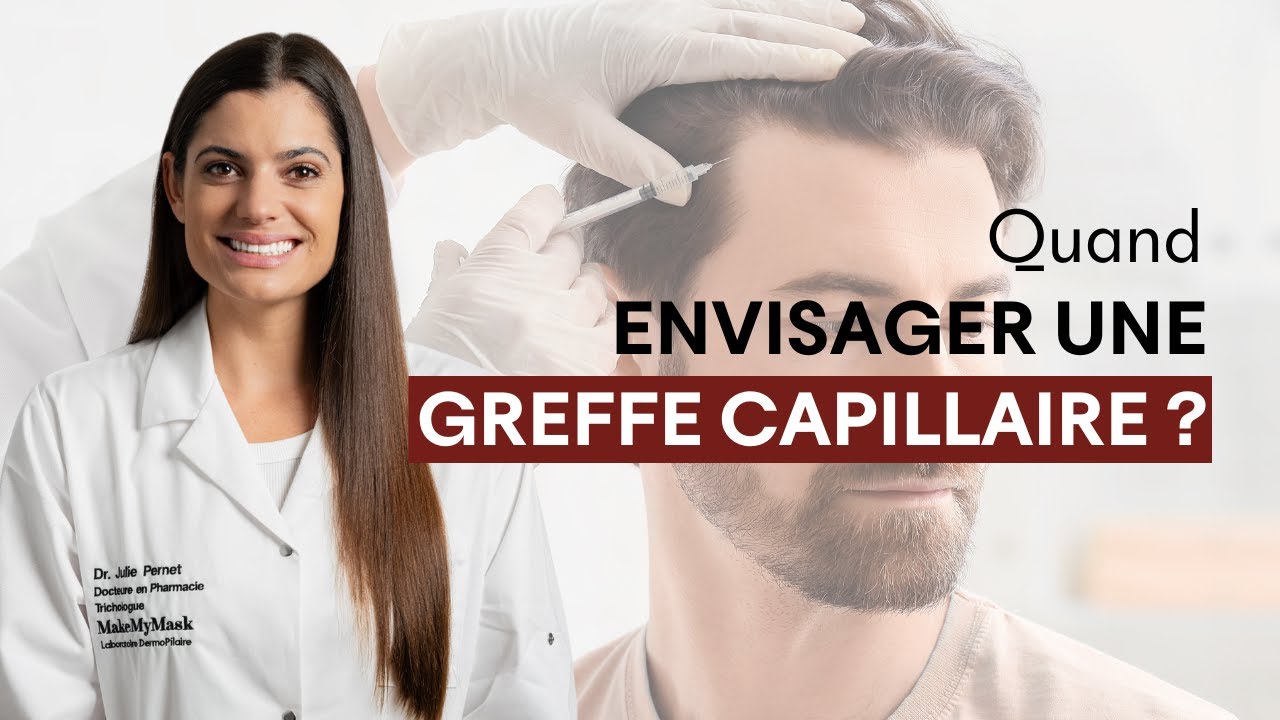 Quand envisager une greffe capillaire ?