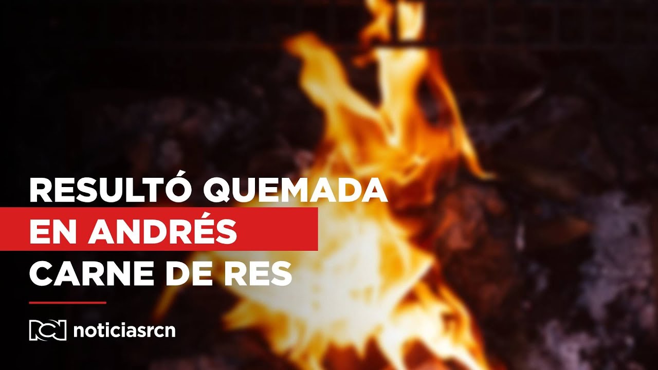 Mujer resultó con graves quemaduras tras show en Andrés Carne de Res