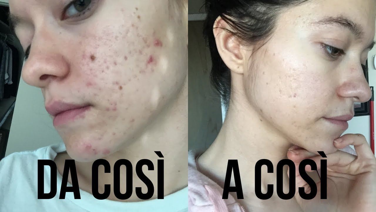 Da Così a Così 5 Pratiche Che Miglioreranno La Vostra Pelle!