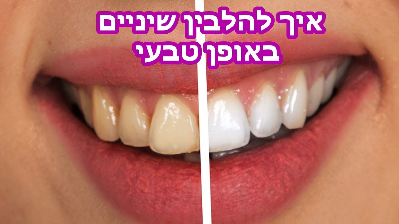 איך להלבין שיניים