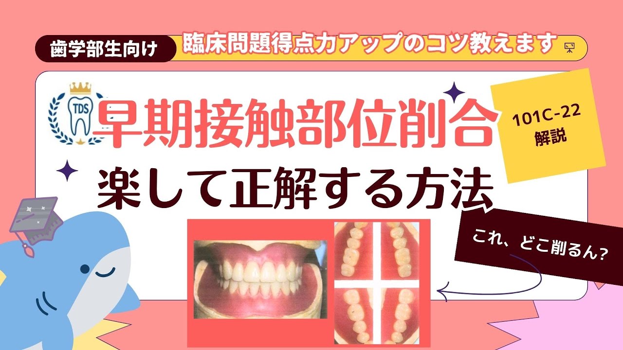 早期接触部位削合　楽して正解する方法　歯科医師国家試験臨床実地対策