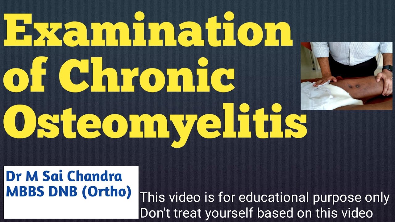 Examination Of Chronic Osteomyelitis