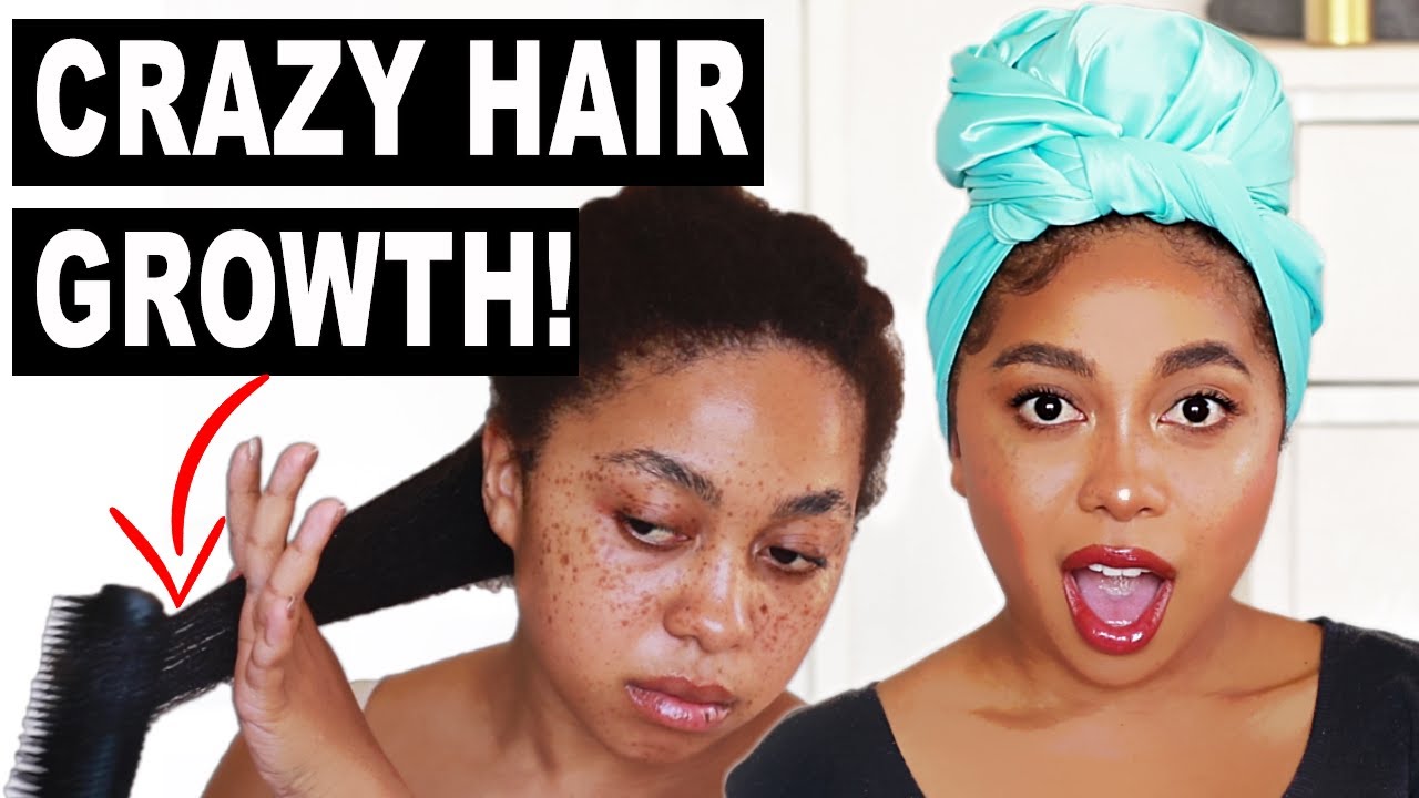 THIS GREW MY HAIR SO FAST! DOUBLE YOUR HAIR GROWTH WITH THIS GAME CHANGING NATURAL HAIR HACK! (2020)