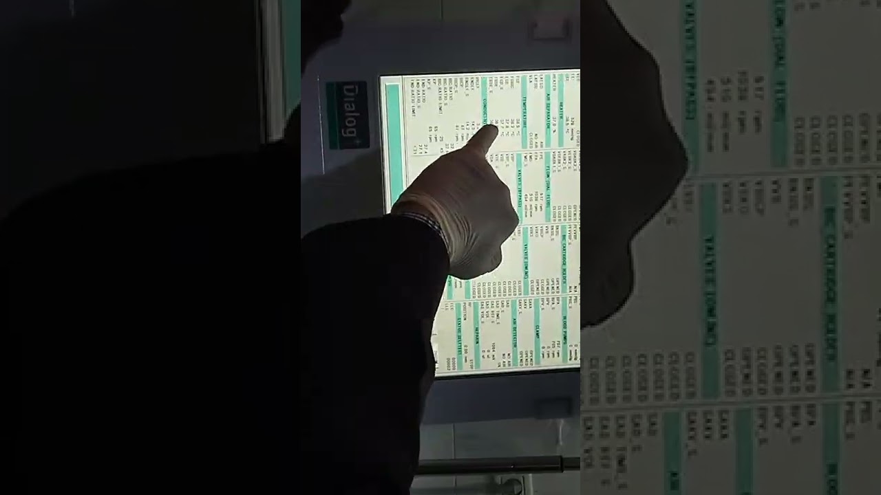 شرح ماكينات الغسيل الكلوي البي براون B/Braun الألماني شرح Tempreture, Conductivity
