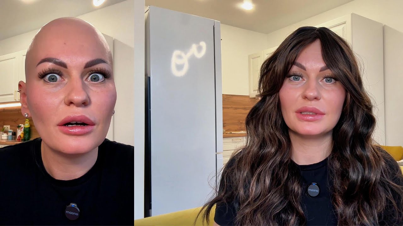 НЕУДОБНЫЕ ВОПРОСЫ: Как на них отвечать? | Алопеция и принятие себя