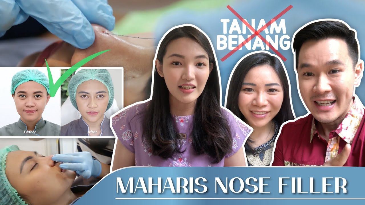 THE DANGERS OF FILLERS OR NOSE THREAD IMPLEMENTATION THAT YOU SHOULD KNOW!