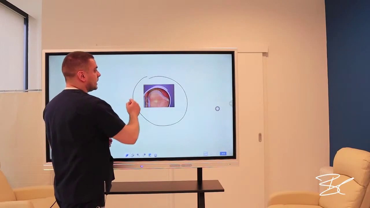 Šta znači kada vidite mušice pred očima?