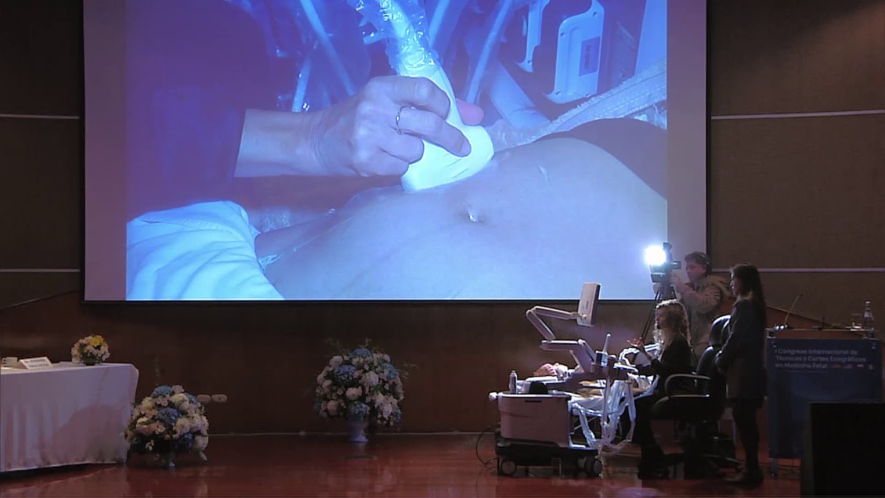 Clase 8 | Demostración Práctica, Doppler de Arterias Uterinas, Umbilical y Cerebral Media