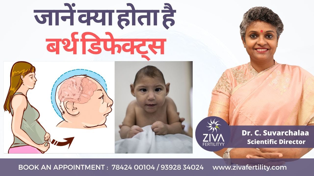 बर्थ डिफेक्ट्स || Most Common Birth Defects || Congenital Anomalies || Dr C Suvarchalaa