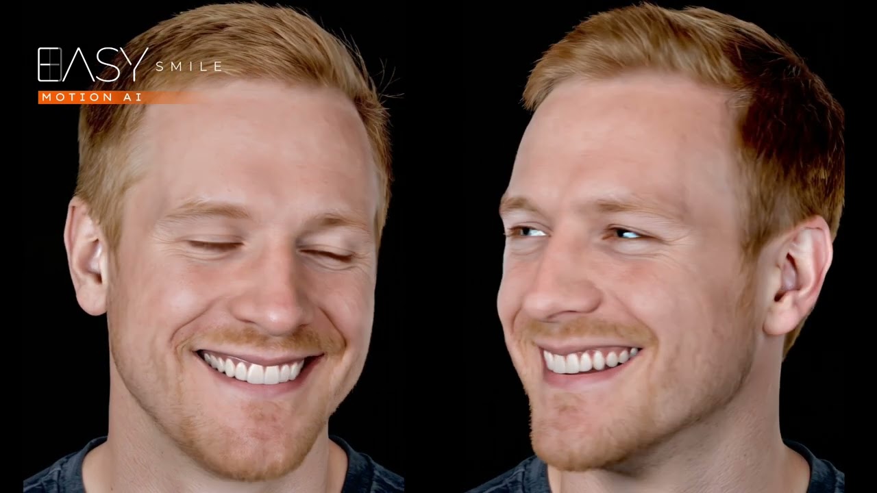 EASY SMILE MOTION