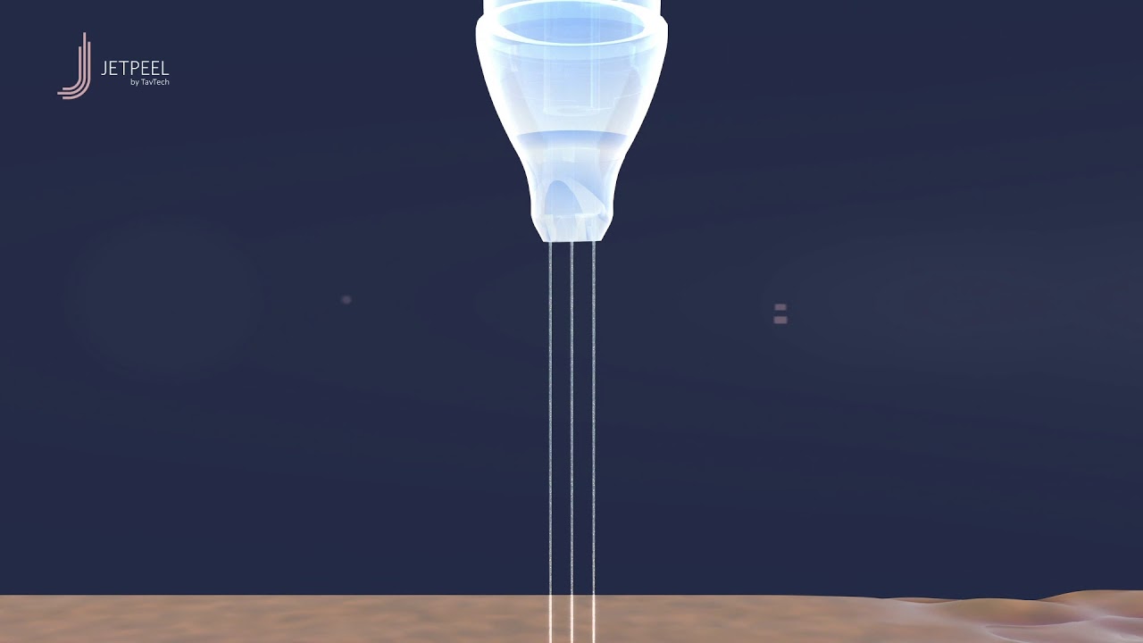 JetPeel Mode of Action