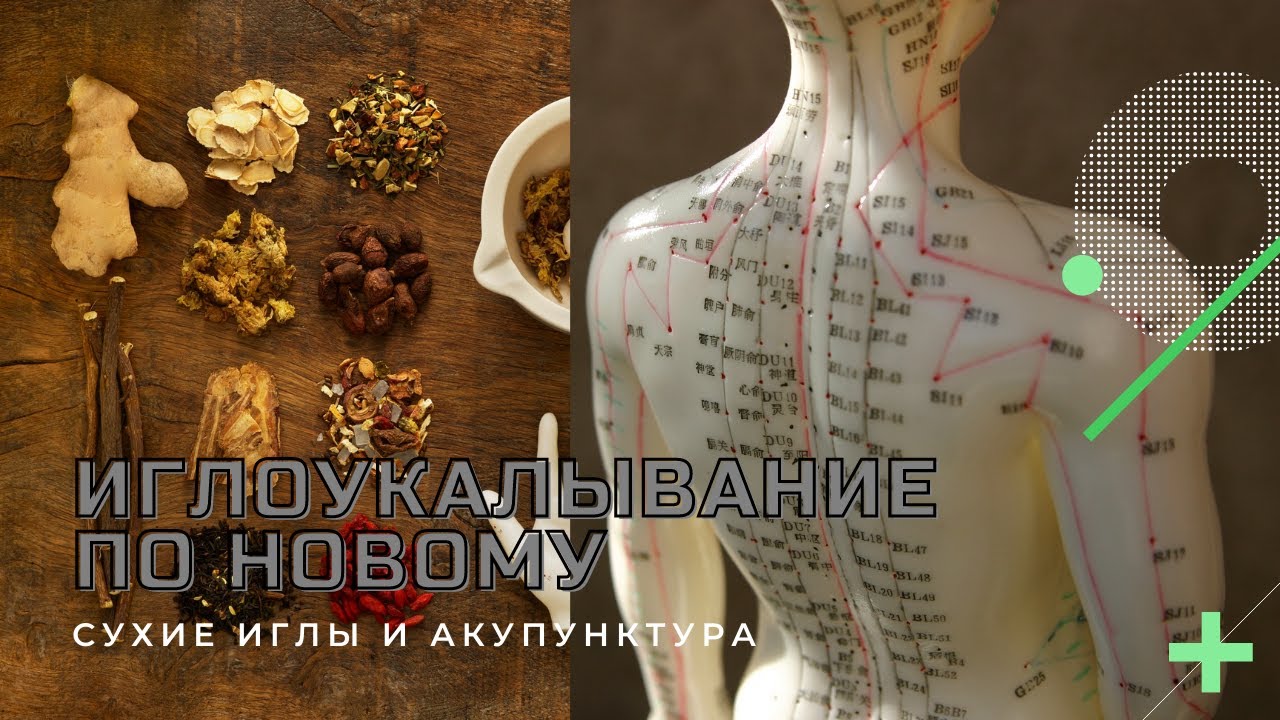 Фасции и синовиальные сумки в иглоукалывании. Акупунктура и сухие иглы