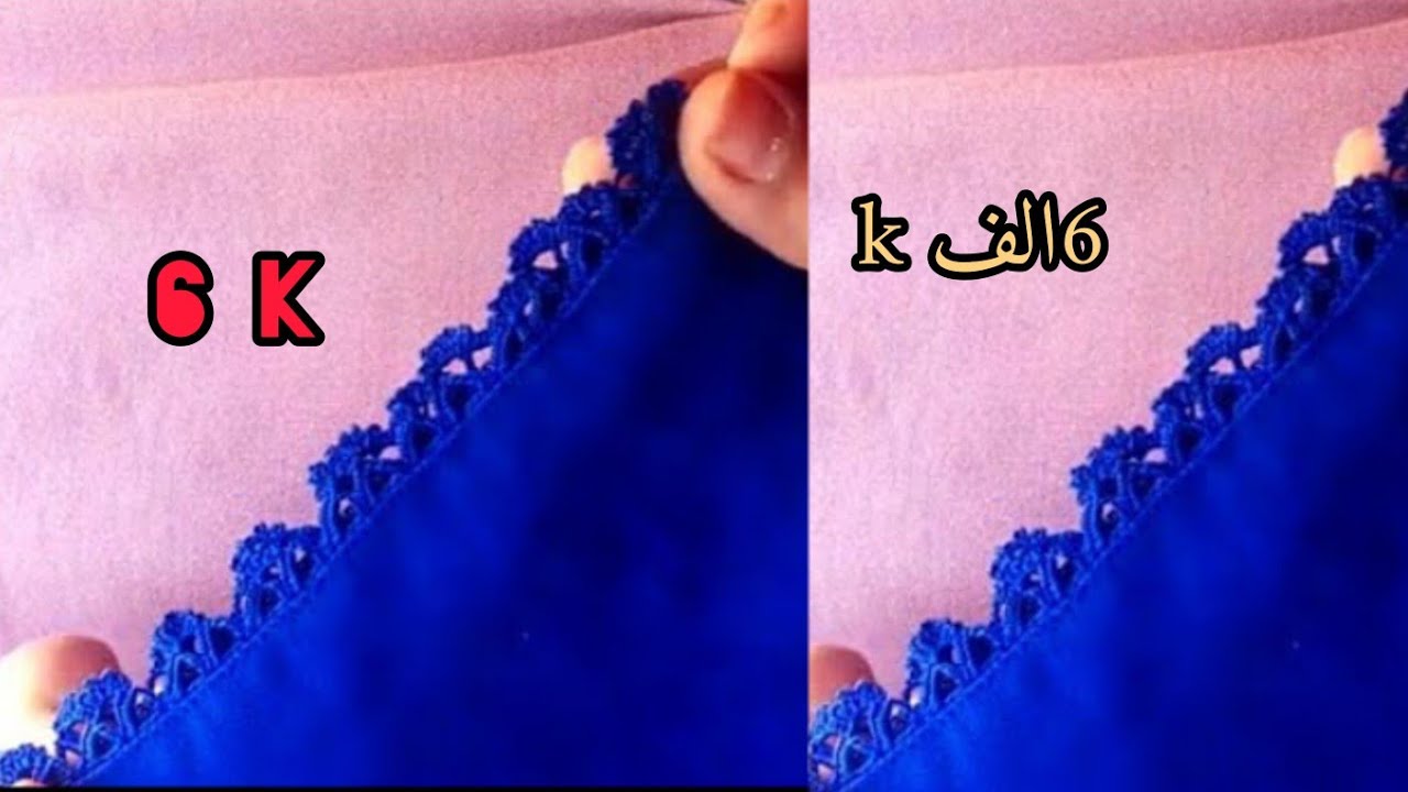 ضرس بالكروشي بحلا راندة سهل