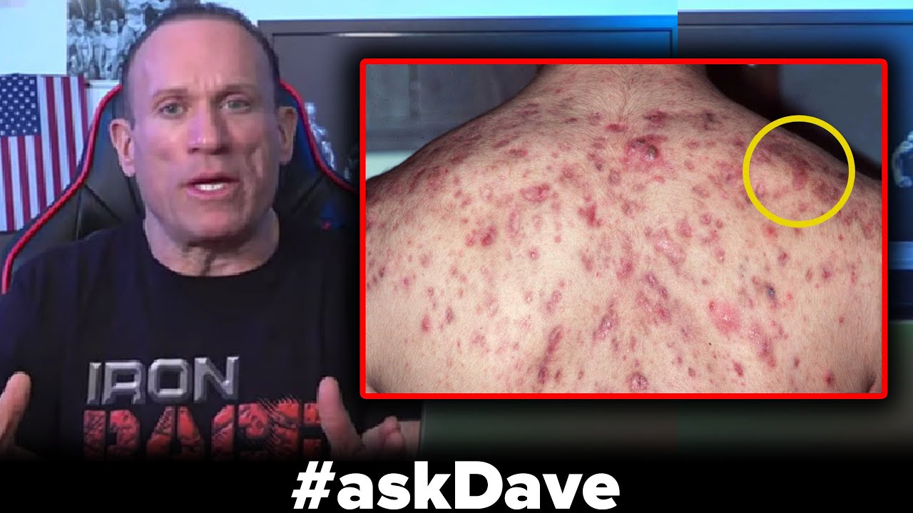 THE WORST 'GEAR' SIDE EFFECTS! #askDave