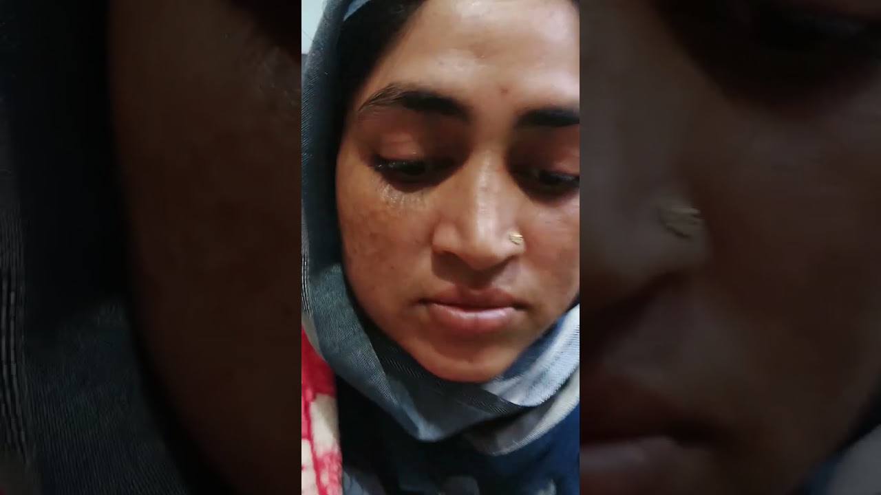 দীর্ঘদিনের ইউরিন ইনফেকশন, জরায়ুতে, ওভারিতে  সিস্ট,মুখে দাগ দুইবারের ওষুধে অনেক ইমপ্রুভমেন্ট। 