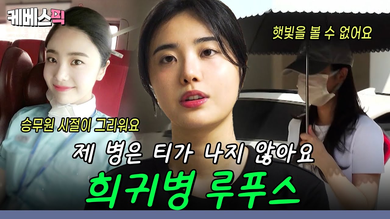 승무원 출신 루푸스 환자 윤희 씨 ✈️ 티가 나지 않는 희귀병 '루푸스' 극복기 💥 #인간극장 [사랑은 기적을 타고 2부]｜KBS 250902 방송