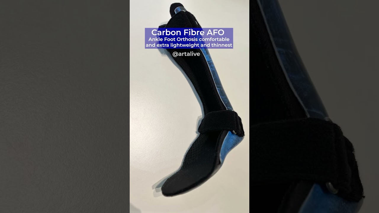 Carbon Fiber AFO #artalive #repair #orthosis