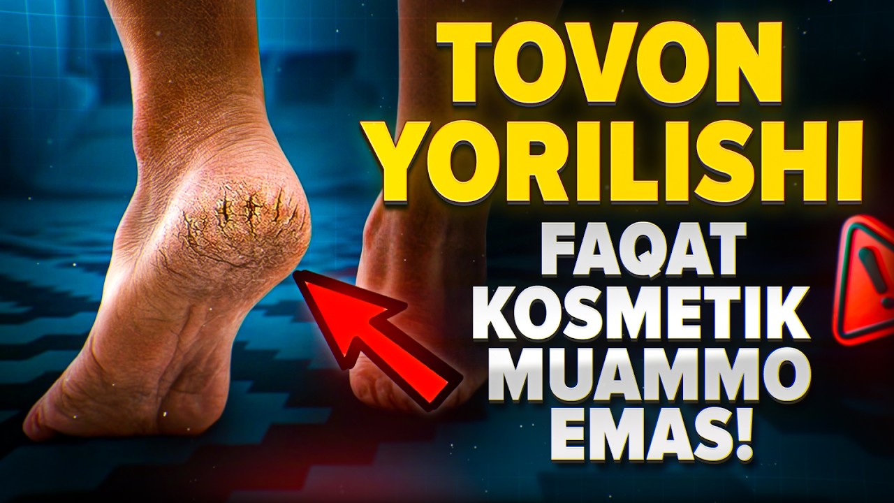 Нега товон ёрилади? | Доктор Гулбаҳор