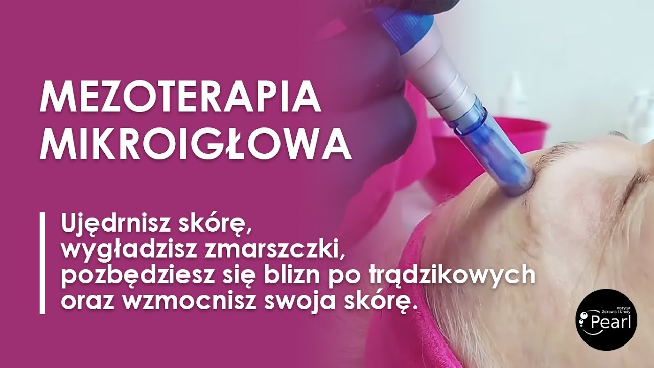 Mezoterapia mikroigłowa - najlepszy zabieg odmładzający
