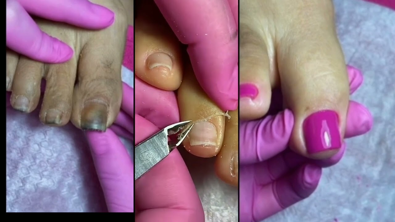 Satisfying Foot Care video