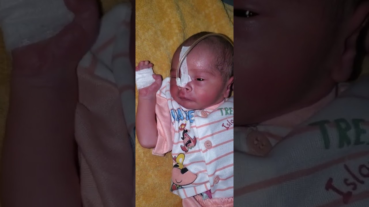 Infant Retraction Breathing..New Born